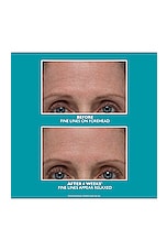 Peptide Skinjection Amplified Wrinkle-Fix Serum - thumbnail 9