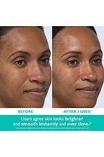 Even Smoother Instant Reveal Facial Peel - thumbnail 5
