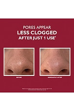 Even Smoother Microdermabrasion Exfoliating Pore Treatment - thumbnail 5