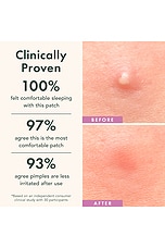 Miracle Patch Overnight Spot Cover - thumbnail 10