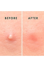 Miracle Patch Microcrystal Spot Cover - thumbnail 9