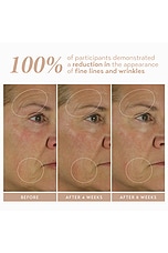 Retinol Reform With 1% Encapsulated Retinol 30ml - thumbnail 7