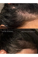 The Hair Serum - thumbnail 5