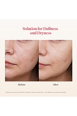 Facial Treatment Mask 6 Pack - thumbnail 9