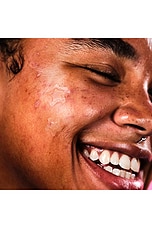 Hydro-Star Clear Pimple Patches - thumbnail 8