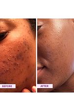 Australian Glow Berries Enzyme Powder Exfoliator - thumbnail 6