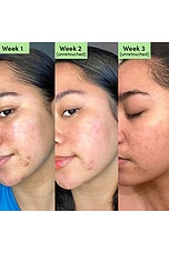 Oil Control Clearing Face Mask - thumbnail 6
