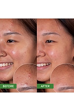 Oil Control Clearing Cleanser - thumbnail 6