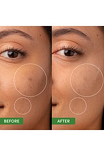 Oil Control Clearing Moisturizer - thumbnail 6