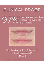 LED Lip Volume Pro Plumping Treatment - thumbnail 5