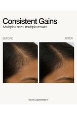 Dermaroller Scalp Ritual Set - thumbnail 7