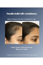 Intensive LED Hair Growth Brush - thumbnail 7