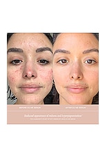 CC Me Serum - thumbnail 8