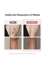 Air 10 IPL Laser Hair Removal Device - thumbnail 8