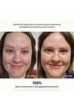 Skin Refine Gentle Pore Clearing Serum - thumbnail 6