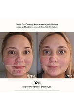 Skin Refine Gentle Pore Clearing Serum - thumbnail 7