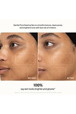 Skin Refine Gentle Pore Clearing Serum - thumbnail 8