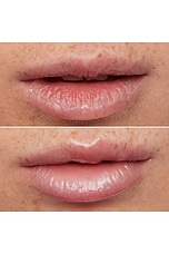 Lip Rehab Serum Oil - thumbnail 8