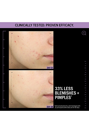 Allies of Skin Azelaic & Kojic Advanced Clarifying Serum in Beauty: NA