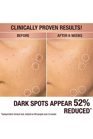 Charlotte Tilbury Dark Spot Correcting Radiance Recovery Serum 30ml in Beauty: NA