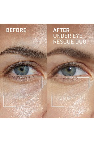 Dr. brandt skencare dúo para el cuidado de los ojos eye rescue en color belleza: N/A