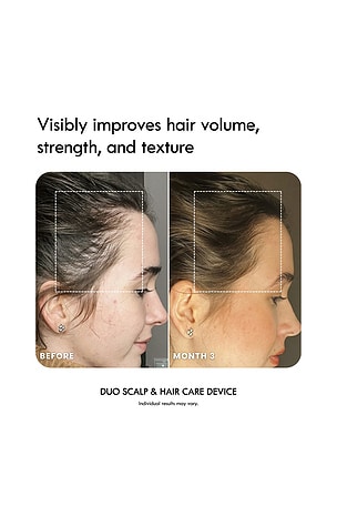 LADUORA Duo 4-in-1 Pod Based Scalp & Hair Care Device