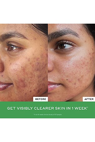 OLEHENRIKSEN Daily D-Clog Pore-Clearing Cleanser in Beauty: NA