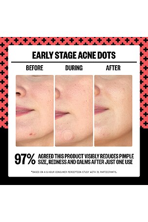 Peace Out PATCHS ANTI-BOUTONS 2% SALICYLIC ACID EARLY STAGE ACNE DOT 8 DOTS en Beauty: S