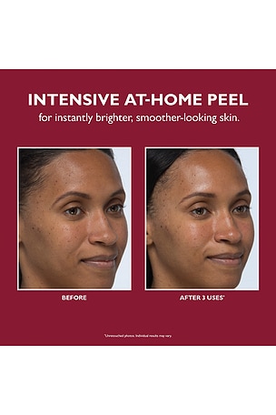 Peter Thomas Roth Even Smoother Instant Reveal Facial Peel in Beauty: NA