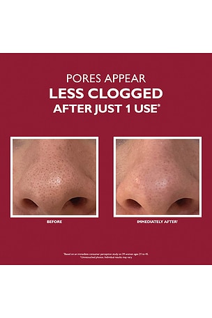 Peter Thomas Roth Even Smoother Microdermabrasion Exfoliating Pore Treatment.