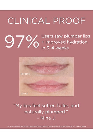 Solaris Laboratories NY LED Lip Volume Pro Plumping Treatment in Beauty: NA