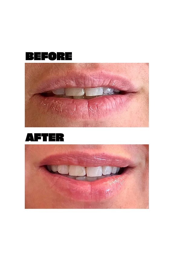 view 2 of 8 Lip Mask in Clear