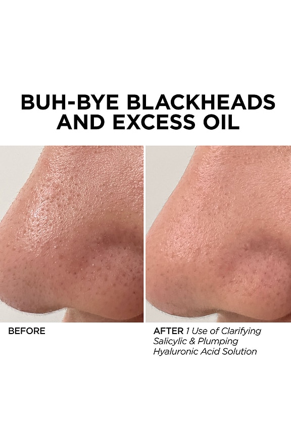 view 2 of 7 CONCENTRADO GLOFACIAL ORIGINAL CONCENTRATE in 