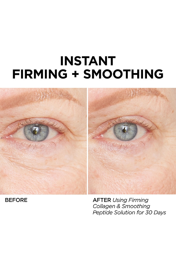 view 2 of 6 CONCENTRADO GLOFACIAL COLLAGEN CONCENTRATE in 