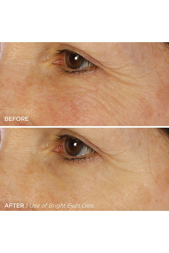 view 2 of 4 Bright Eyes Depuffing & Brightening Eye Gels in 