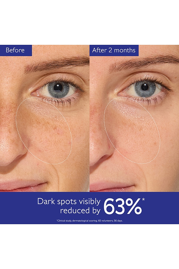 view 2 of 9 Vinoperfect Dark Spot Serum 50ml in 