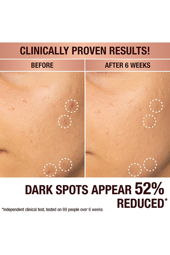 view 2 of 9 Dark Spot Correcting Radiance Recovery Serum 30ml in 