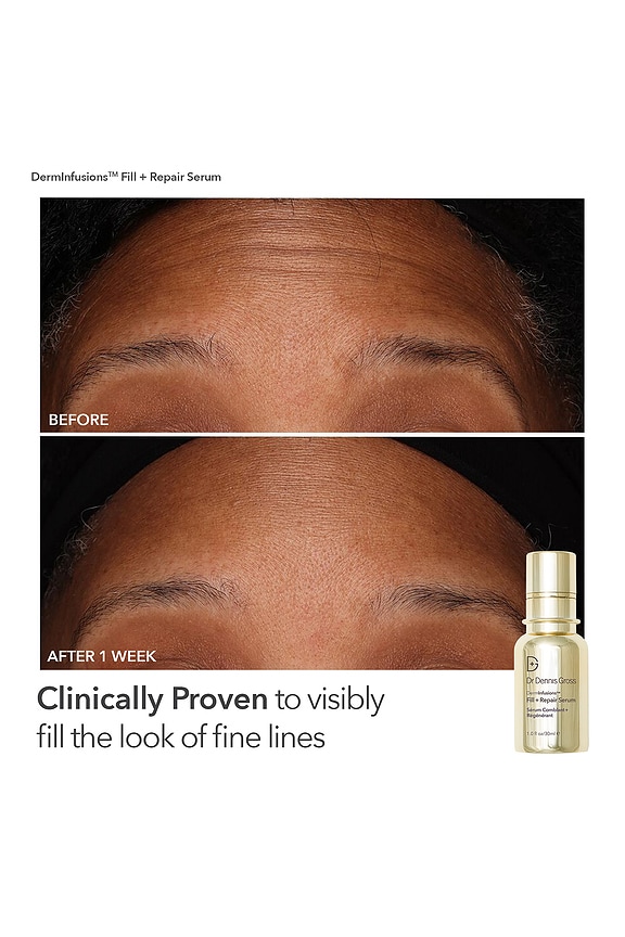 view 2 of 6 Fill, Plump, & Firm Set in 