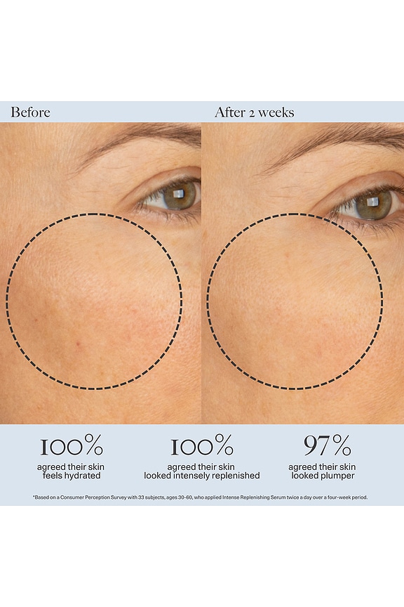 view 2 of 2 SUERO CARA INTENSE REPLENISHING in 