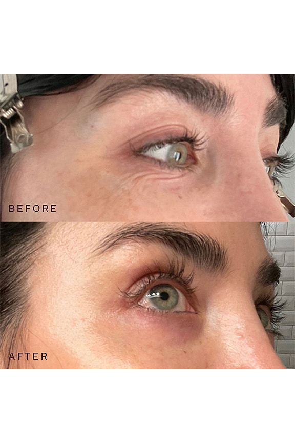 view 2 of 6 ANTIFAZ EYES & MOUTH PATCHES in 