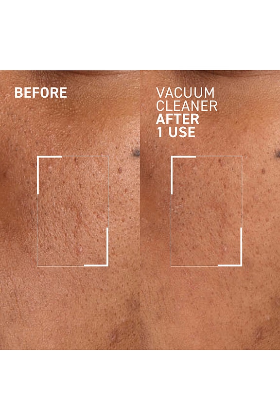 view 2 of 2 Pores No More Vacuum Cleaner Mask in 