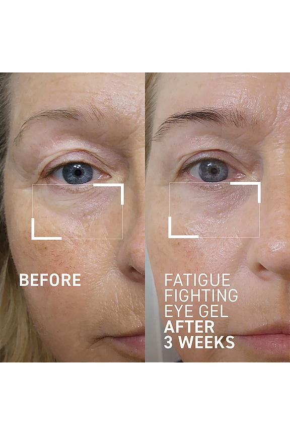 view 2 of 7 Id-stress Fatigue Fighting Eye Gel in 