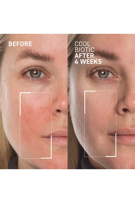 view 2 of 6 Cool Biotic Prebiotic Redness Relief Cream in 