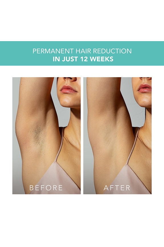 view 2 of 4 SET in Mint