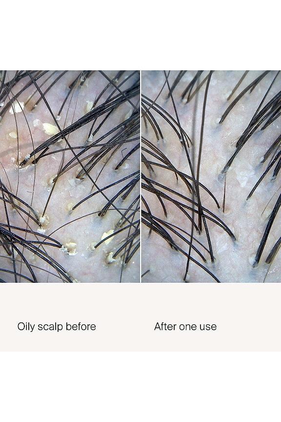 view 2 of 7 SCALP CARE EXFOLIATOR 두피 트리트먼트 in 