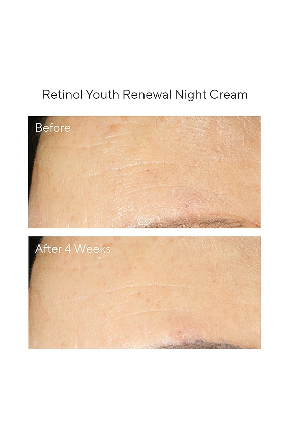 view 2 of 3 SUERO DE RETINOL RETINOL YOUTH RENEWAL SERUM in 