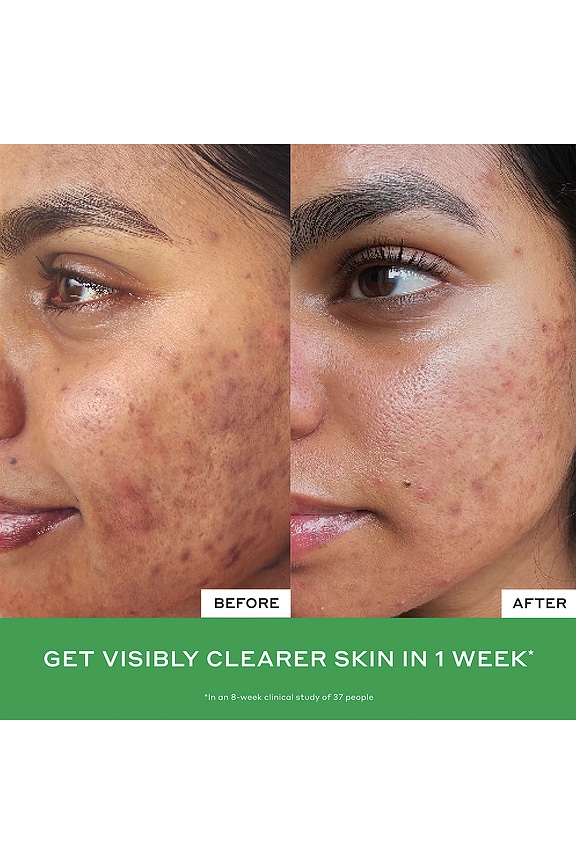 view 2 of 7 LIMPIADOR PARA LA CARA DAILY D-CLOG in 