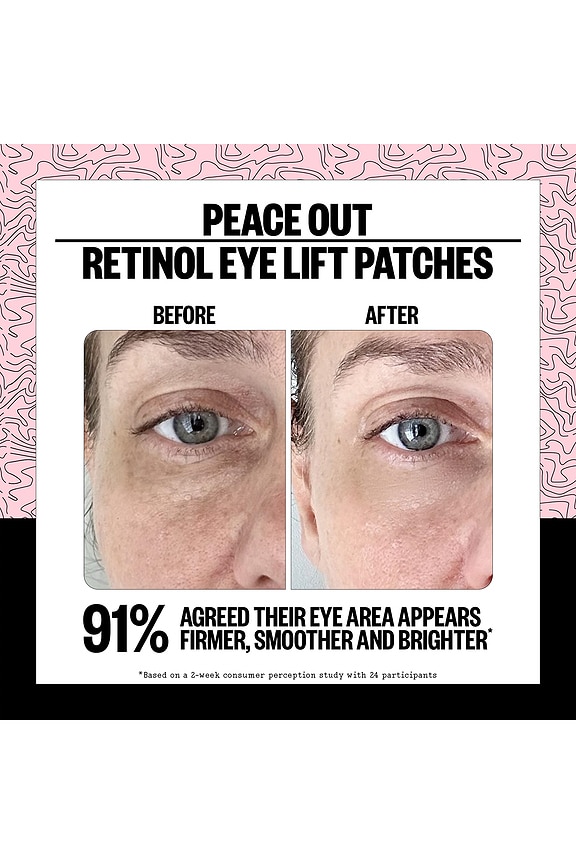 view 2 of 7 PATCHS POUR LES YEUX 360° EYE LIFT PATCHES TO LIFT, FIRM AND REVITALIZE EYES in 