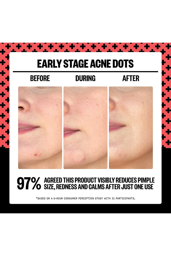 view 2 of 6 2% Salicylic Acid Early Stage Acne Dot 8 Dots in 