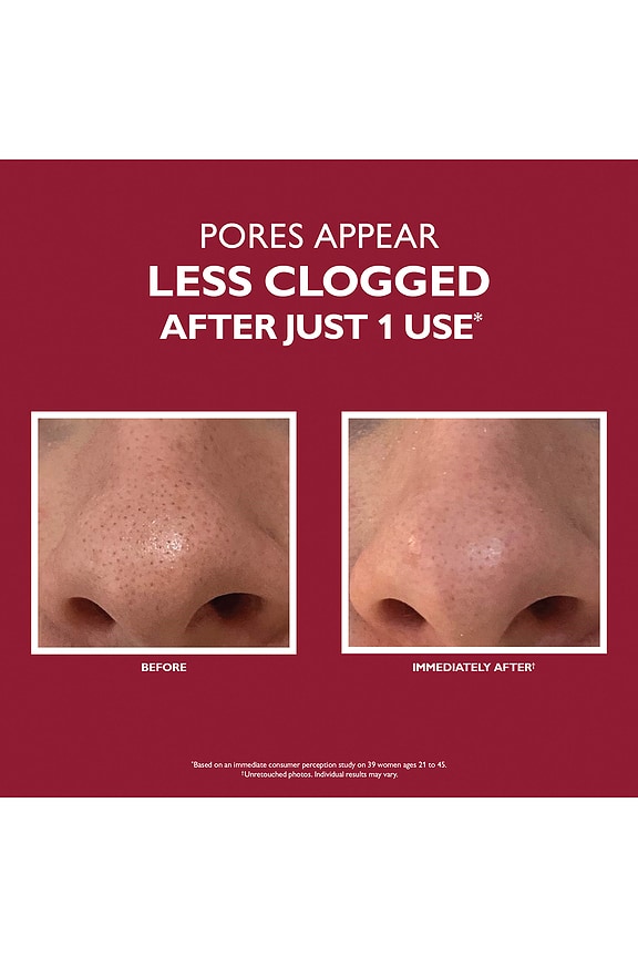 view 2 of 6 Even Smoother Microdermabrasion Exfoliating Pore Treatment in 